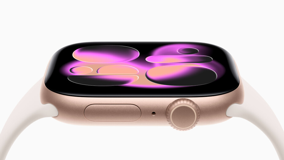 APPLE WATCH SERIES 11