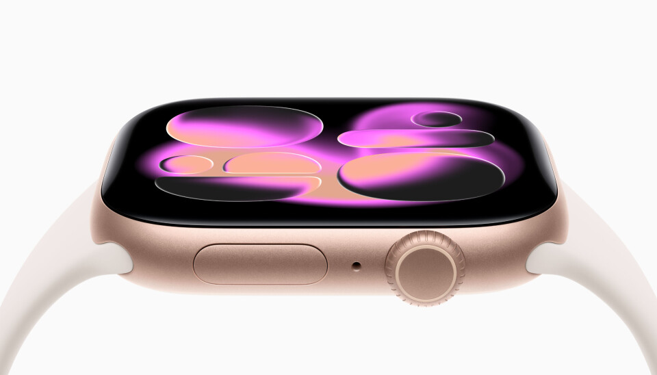 Apple Watch Series 11. Foto: Apple
